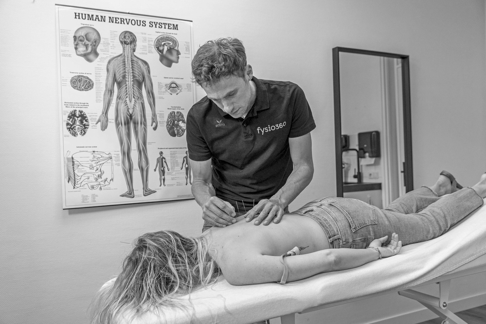 acupunctuur-dirk-fysio360-denekamp-02
